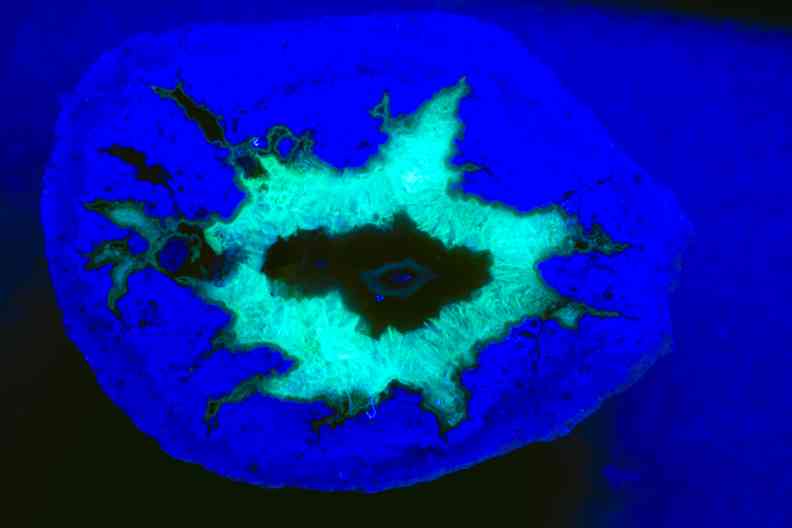 Lithopyhse Chalcedon