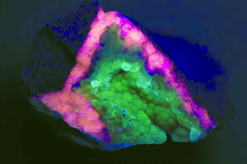 Chalcedon
        Sailauf UV-Licht
